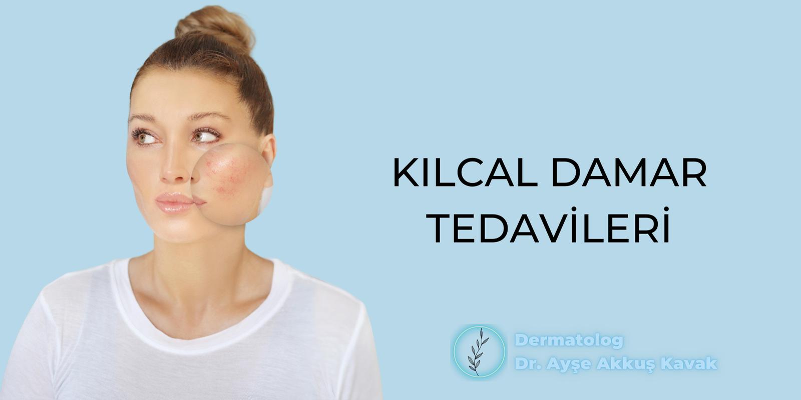 Kılcal Damar Tedavileri