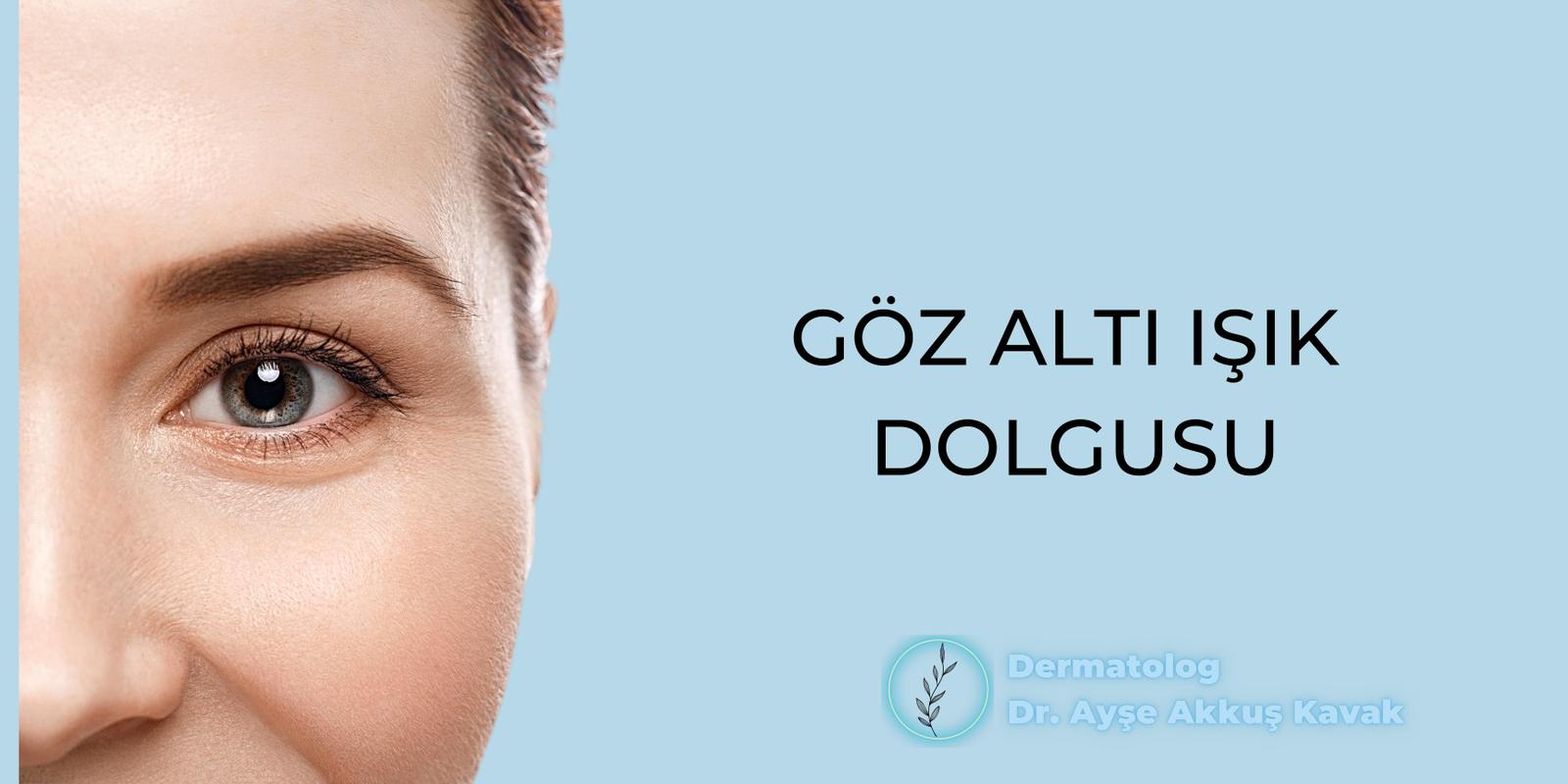 Gözaltı Işık Dolgusu