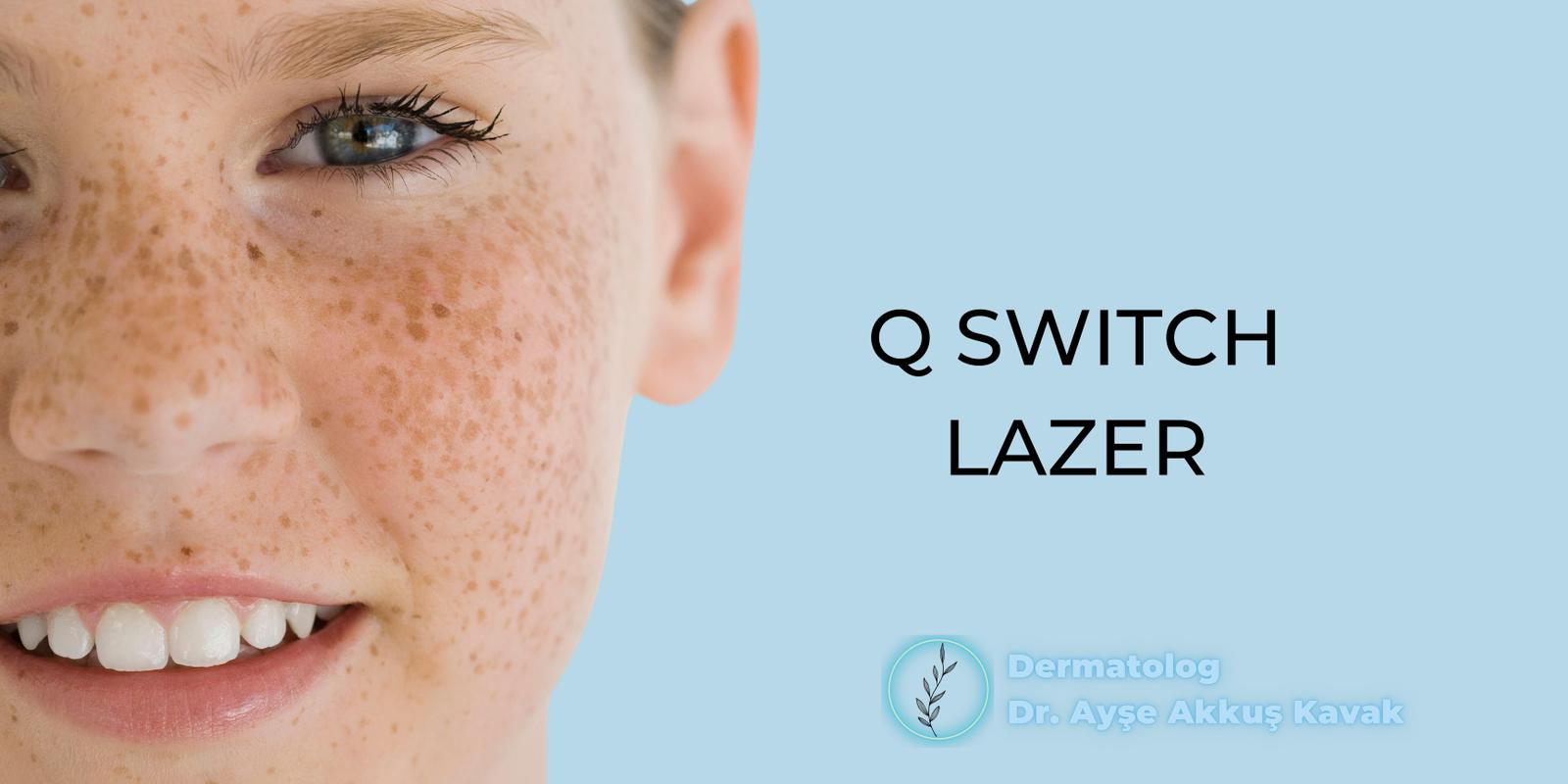 Q-Switch Lazer