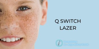 Q-Switch Lazer