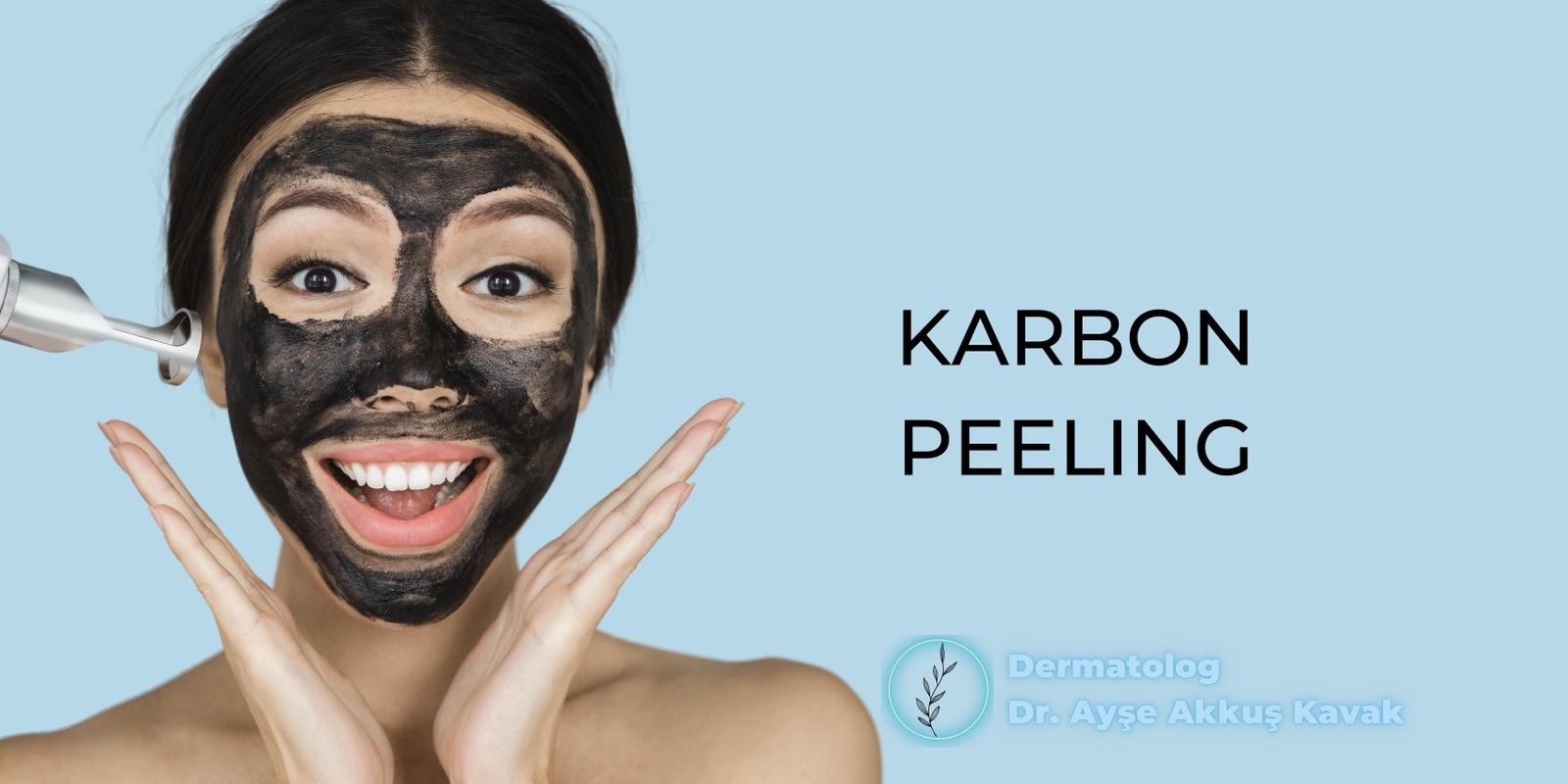 Karbon Peeling