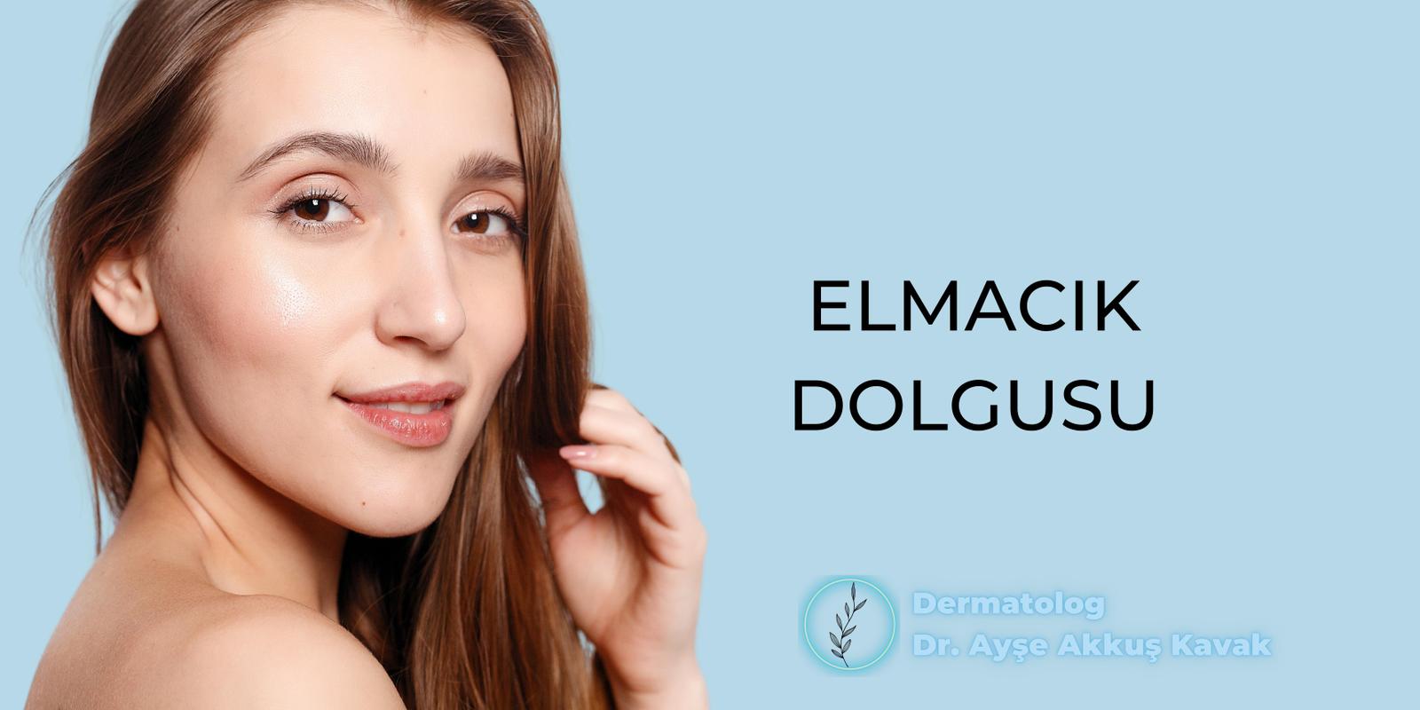 Elmacık Dolgusu